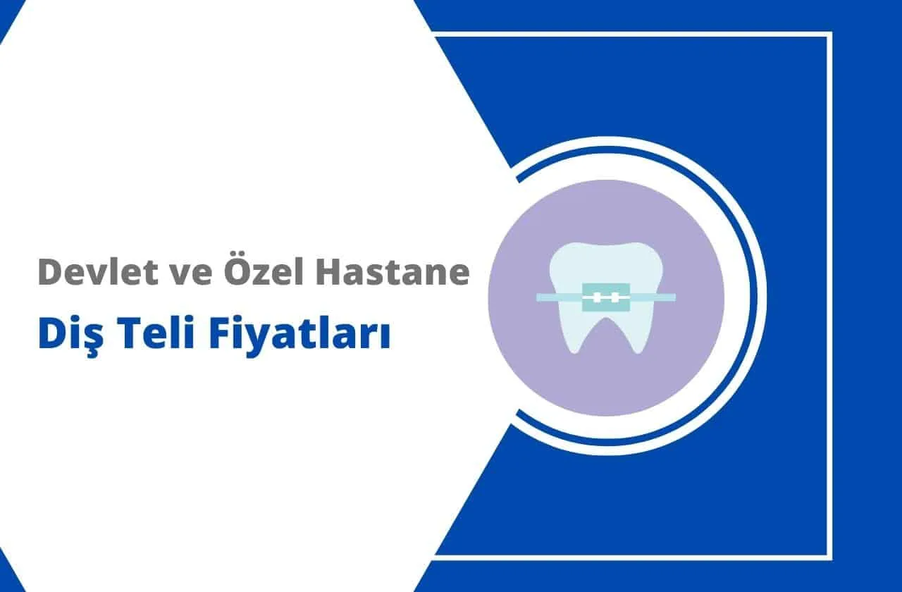 Diş Teli Takan Devlet Hastaneleri ve Fiyatları 2024