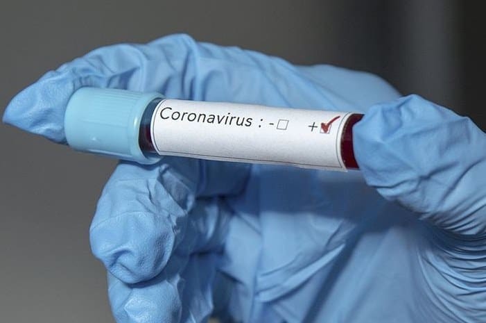 dunya bankasindan koronovirus icin yardim hazir