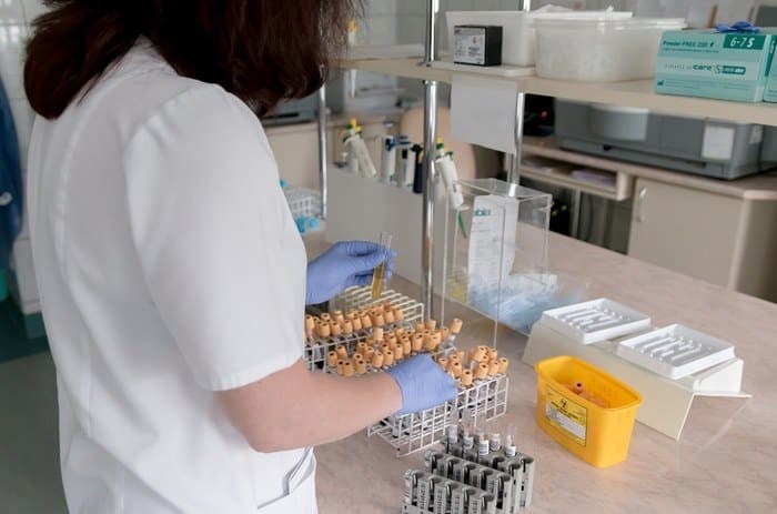 turkiyede korona tedavisinde basari saglandi