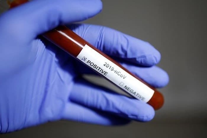 14gun karantina yasagi kaldirildi